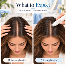 Lumora Deoxyribose 2% Scalp Serum